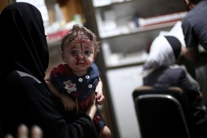 В Сирии в результате действий российской авиации погибло 443 ребенка