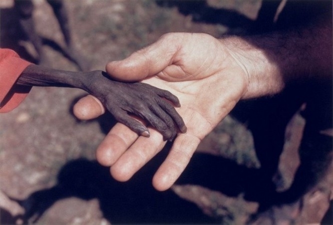 Понад 20 млн людей опинилися під загрозою смерті від голоду
