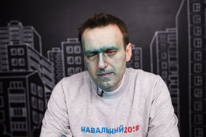 Хімічний опік ока Навального може бути невиліковним