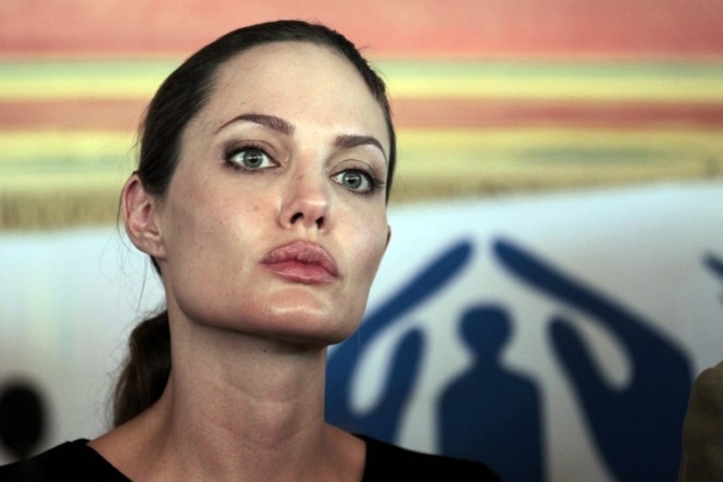 Анджеліні Джолі видалили молочні залози через загрозу раку