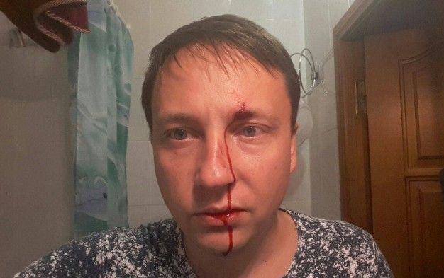 На Одещині побили депутата міськради
