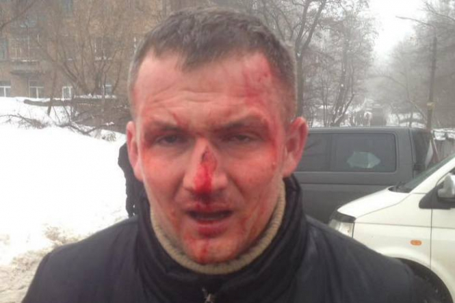 Левченка побили у Києві:депутат намагався кинути 