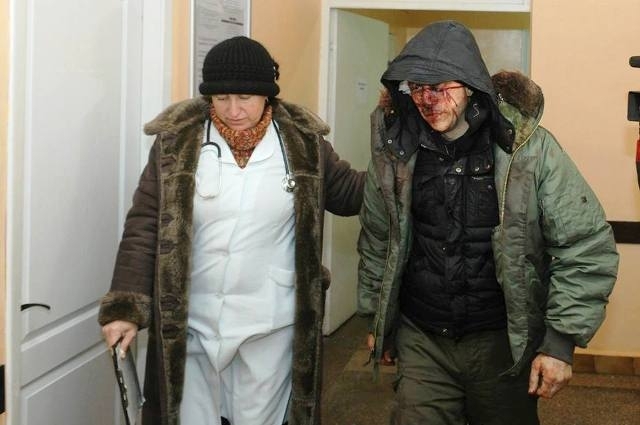 Черкаська міліція прямо в лікарнях арештовує покалічених активістів, - фото