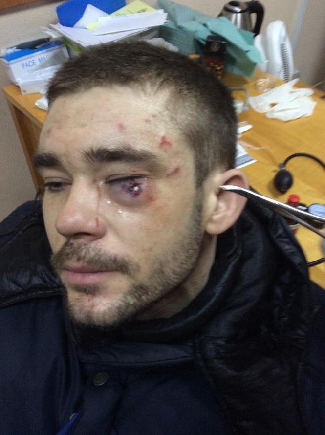 В результате столкновений на Грушевского одному из демонстрантов резиновой пулей повредили глаз