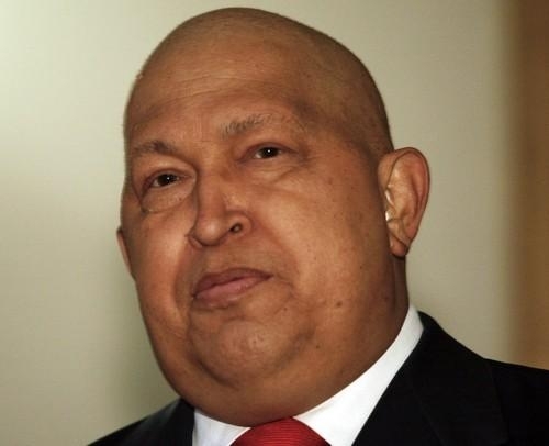 Стан Уго Чавеса після операції залишається складним