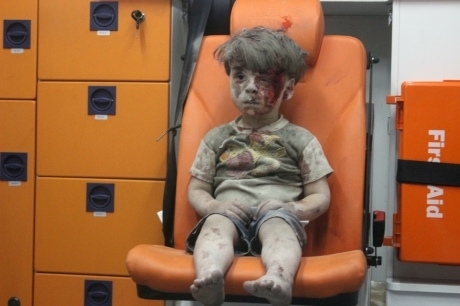 Bellingcat довів причетність Росії до поранення сирійського хлопчика Омрана Дакніша