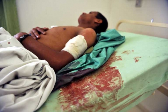 Теракти в Ємені: унаслідок підриву смертників загинуло 45 осіб