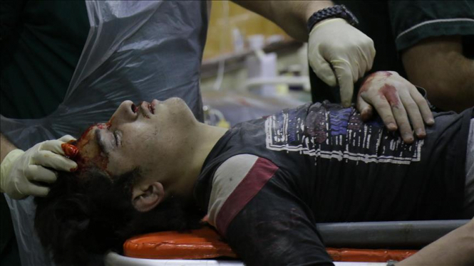 В Сирии в результате авиаудара по детской больницы погибли 17 мирных жителей