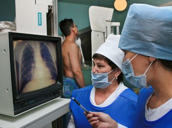 Переселенців з Донбасу в анексованому Севастополі звинуватили в поширенні туберкульозу