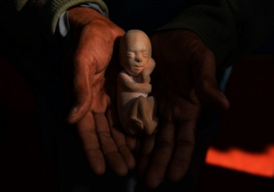 В Раду внесли законопроект, который предусматривает право медиков отказать в аборте