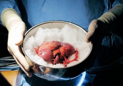 Трансплантологія: трохи лікнепу