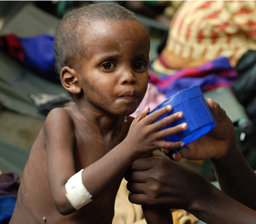 В світі на межі голоду опинилися 35 млн людей – ООН
