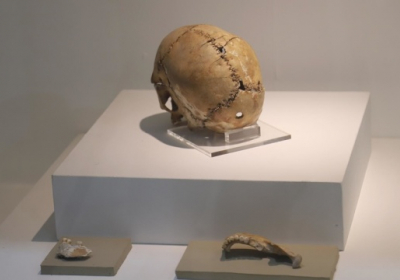 У Туреччині дослідили череп зі слідами трепанації, якому 9,5 тисячі років