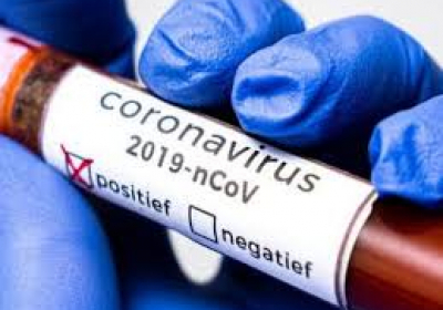 В Украине зафиксировано 11 932 новых случая коронавирусной болезни COVID-19