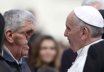 Чтобы благословить мужчину с деформированным лицом Папа Римский прервал проповедь (фото)