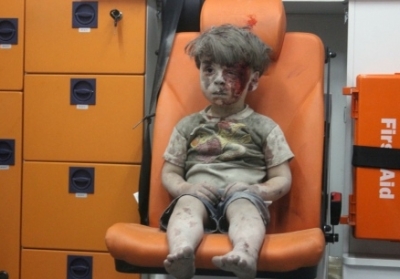 Bellingcat довів причетність Росії до поранення сирійського хлопчика Омрана Дакніша