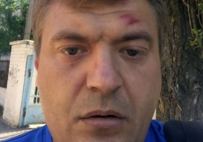 Побитий херсонський журналіст впізнав своїх нападників