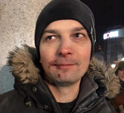 Егора Соболева избили во время акции протеста в Киеве