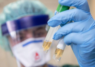 Еврокомиссия выделила 100 миллионов евро для покупки экспресс-тестов на антигены