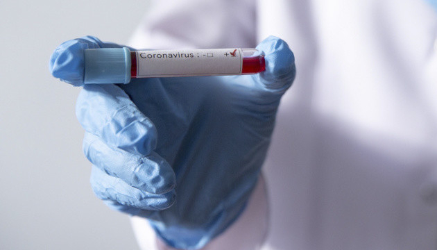 В Україні дев’ятьох людей перевіряють на коронавірус - МОЗ