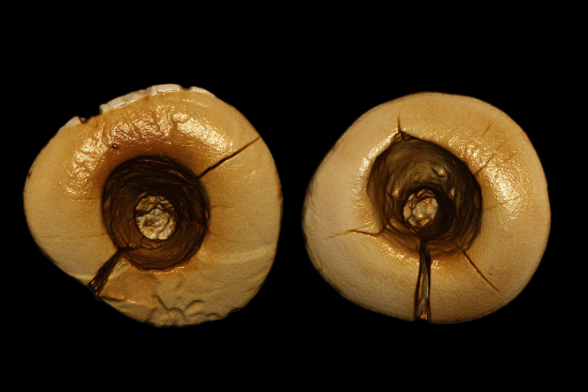 В Італії археологи віднайшли зубні пломби, яким 13 тисяч років
