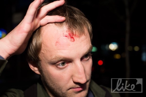 Охоронець Кіркорова пляшкою розбив голову українському фотографу