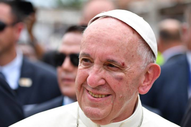 Папа Римський закликав путіна і Зеленського знайти "вихід з кризи"