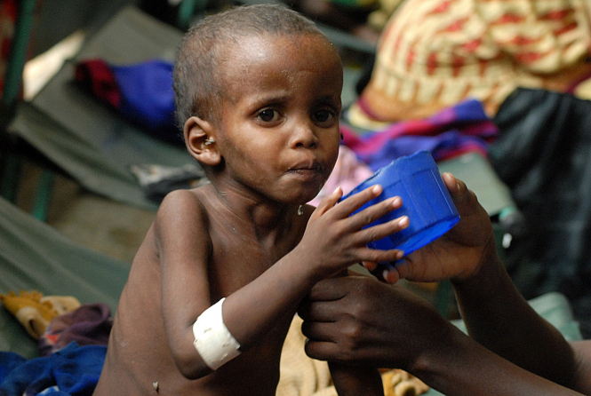В світі на межі голоду опинилися 35 млн людей – ООН