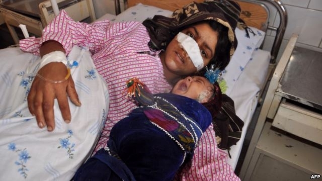 В Афганистане мужчина отрезал жене нос