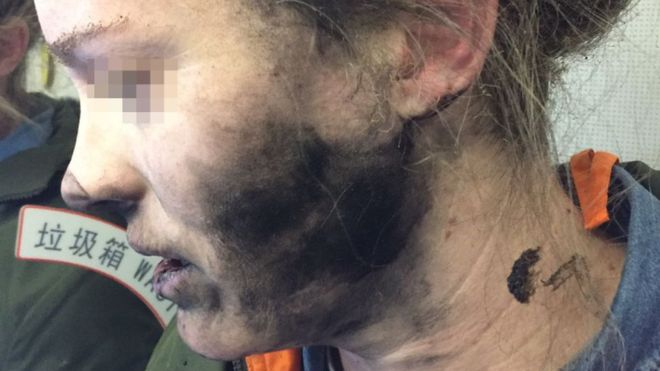 У женщины во время полета в самолете взорвались наушники - ФОТО