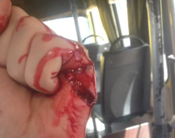 В Киеве водитель маршрутки порезал добровольца АТО и отказал в льготном проезде