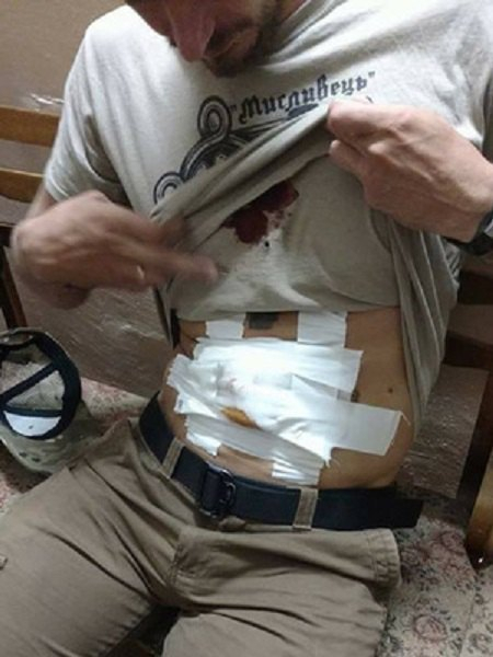 Стрельба в Одессе: ранены лидера городской организации ВОО 
