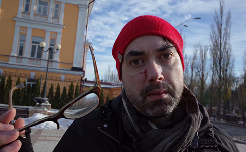 Из-за нападения на канадского фотографа в Киеве открыто производство