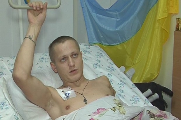 У боях під Дебальцевим 24-річний солдат залишився без руки: він потребує допомоги