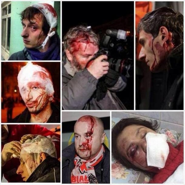 За время массовых протестов в Украине пострадало 136 журналистов