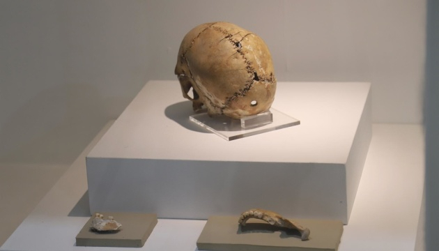 У Туреччині дослідили череп зі слідами трепанації, якому 9,5 тисячі років