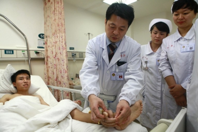 Китайські лікарі врятували чоловіку відірвану руку, пришивши її до ноги 