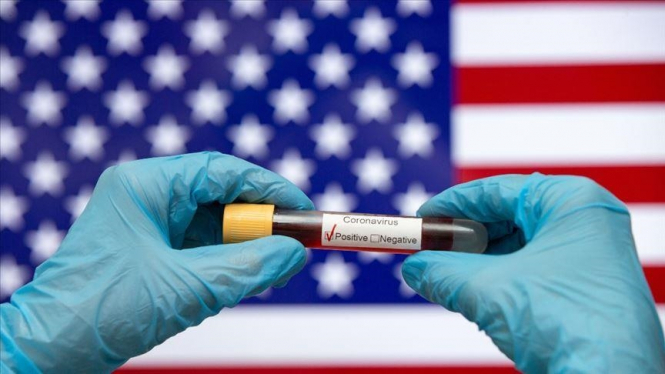 США скасовують вимоги щодо вакцинації від COVID для іноземних мандрівників – Reuters
