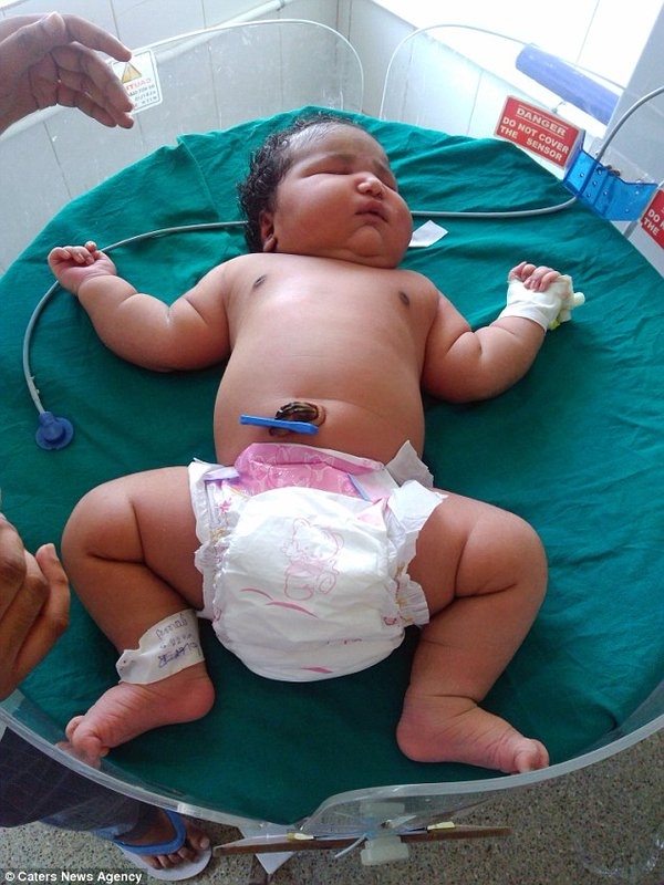 В Индии женщина родила самого тяжелого в мире ребенка