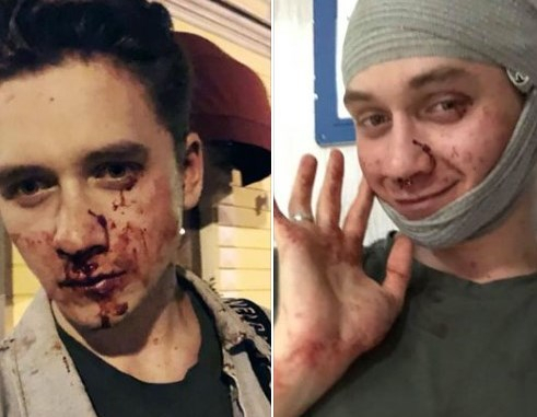 У Києві невідомі побили двох хлопців, нібито, через 