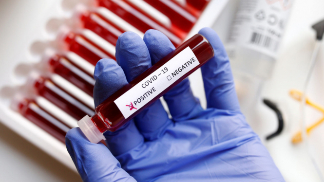 В Україні зафіксовано 7 483 нові випадки коронавірусу