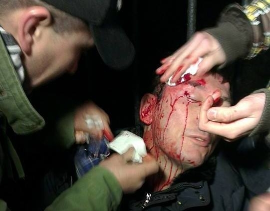 Беркут избил Луценко во время стычки возле Киево-Святошинского суда (видео)