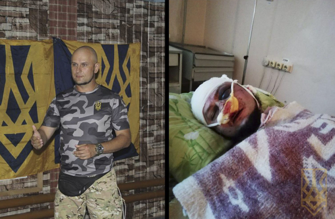 На Дніпропетровщині побили нацдружинника: чоловік у реанімації в критичному стані