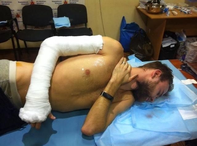 Активист Евромайдана с поломанной рукой и разрывом легкого вырвался из рук 