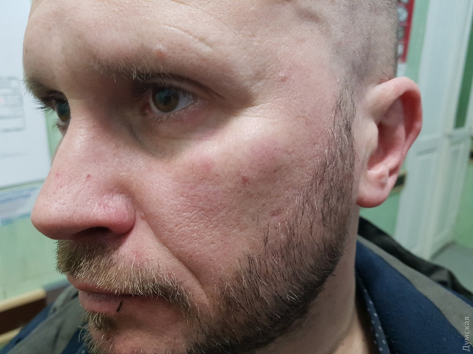 В Одесі напали на журналіста 