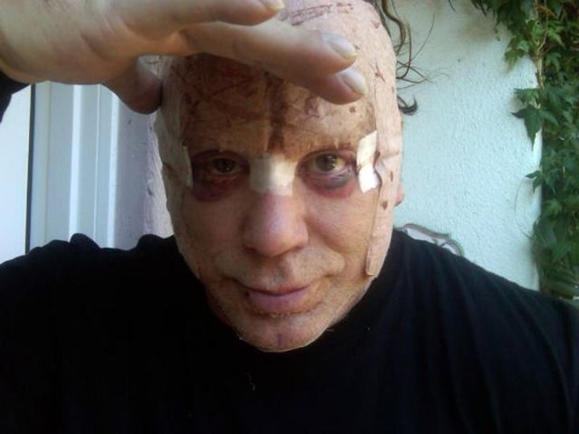 Міккі Рурк показав обличчя після пластичної операції (фото)