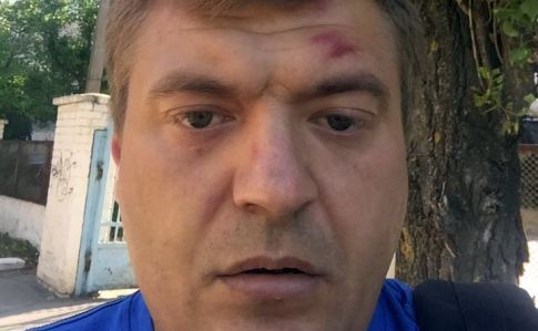 Избитый херсонский журналист узнал своих нападающих