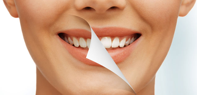 Что нужно знать об отбеливании зубов
