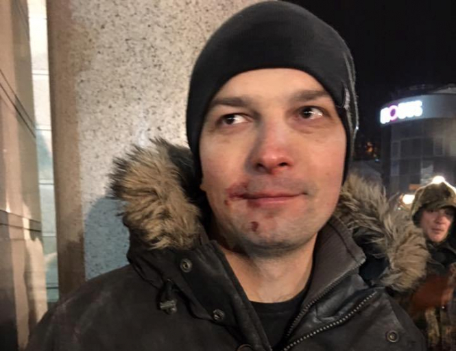 Єгора Соболєва побили під час акції протесту в Києві