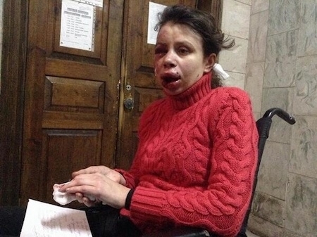 Уночі жорстоко побили журналістку Тетяну Чорновол (відео)